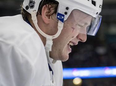 Toronto Maple Leafs defenceman Morgan Rielly reacts to a cut on his face on the bench while taking on the Ottawa Senators during the second period of an NHL pre-season hockey game in Saskatoon, October 4, 2016.
