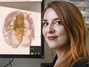 Chelsea Ekstrand helped develop both a 3D model brain and virtual reality brain based on her own MRI. She was photographed in her office at the University of Saskatchewan, Thursday, November 17, 2016.  (GREG PENDER/STAR PHOENIX)