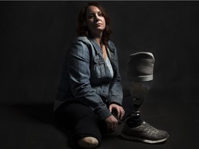 Chauna Welder Leek's right leg was amputated below the knee two years ago, after years of surgeries following a drunk-driving crash. She was the passenger in a truck that rolled.