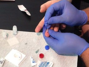 A point-of-care HIV test being administered at the Health Initiative for Men in Vancouver on National HIV Testing Day is shown in a handout photo. The number of newly diagnosed HIV cases in Saskatchewan has increased for a third-straight year. The province diagnosed 177 new cases of HIV in 2017, which is up from 170 a year prior.