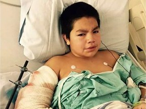 Adrien Sewap was shot in the elbow by a shotgun on a trip organized his band in October 2017. Sewap said a supervisor on the trip handed a shotgun and ammunition to a boy who then shot Sewap at close range on Oct. 14, 2017. Sewap was airlifted to hospital in Saskatoon, where he spent 39 days. The supervisor was eventually charged with careless storage of a firearm, but the charges were stayed earlier this year. Provided photo.