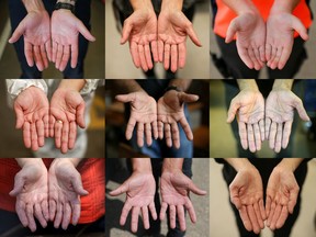These are the hands of some of the cleaners that have been on the front lines of the COVID-19 crisis in Saskatoon for months.