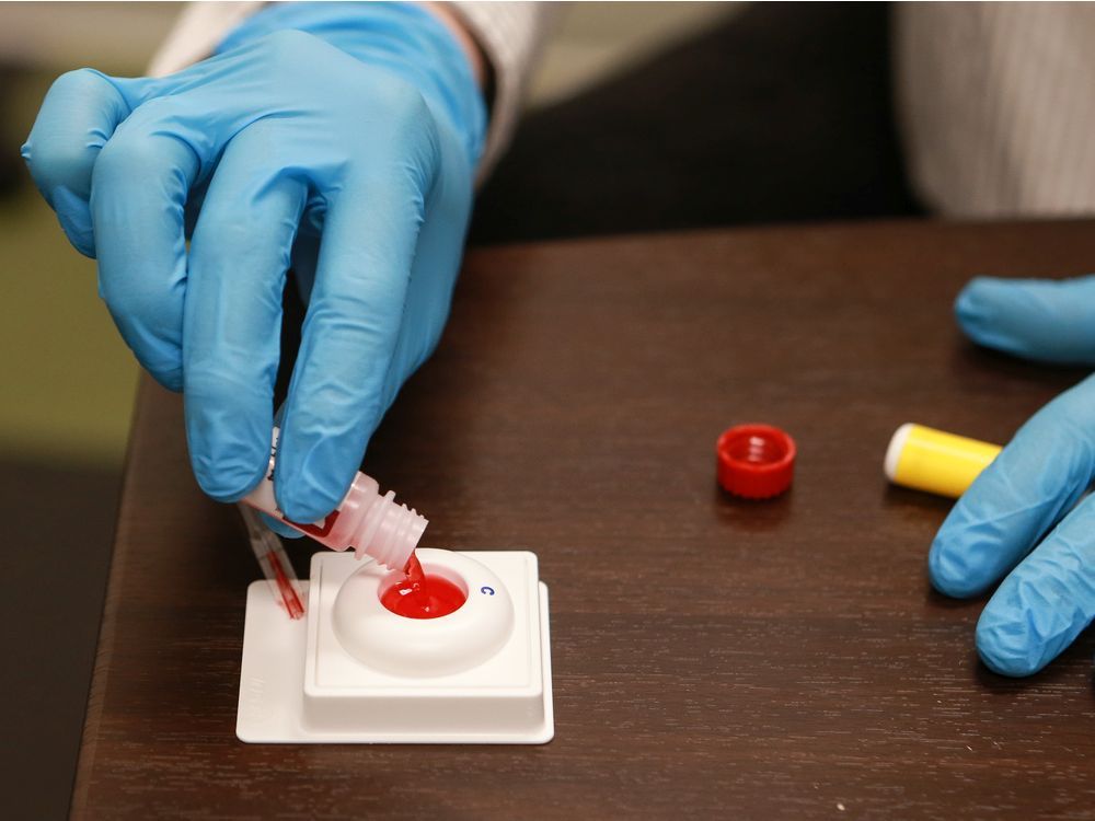 An HIV rapid test and blood draw are performed at Sexual Health Saskatoon.