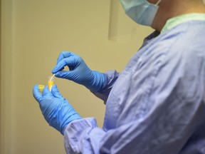 After performing the test, a specimen is collected from the swab in a container, which is then sent to the laboratory for processing. 
Photos of COVID-19 testing from Regina, Sask. Saskatchewan Health Authority supplied photo.