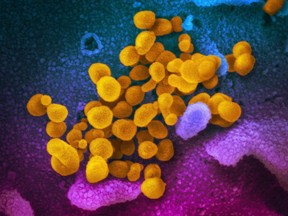 This undated handout electron microscope image made available by the U.S. National Institutes of Health in February 2020 shows the novel ccronavirus SARS-CoV-2, yellow, emerging from the surface of cells, blue/pink, cultured in the lab from a sample isolated from a patient in the U.S.