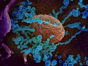 An electron microscope image shows SARS-CoV-2, the virus that causes COVID-19, as it emerges from cells cultured in the lab.