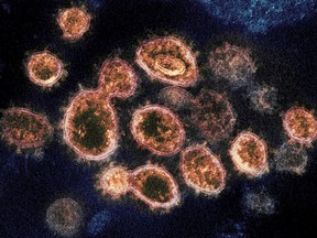 Particles of the virus that causes COVID-19 emerge from the surface of cells isolated from a patient in the U.S. and cultured in a lab in a 2020 electron microscope image.
