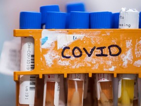 Specimens to be tested for COVID-19 are seen on Thursday, March 26, 2020.