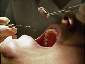 File art of a dental procedure. Dental therapists — previously known as dental nurses — work in rural and remote communities and provide basic oral health services, including prevention, fillings and extractions.