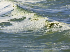 Algae is seen in Saskatchewan lake water.