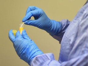 A COVID-19 test specimen is collected from the swab in a container.