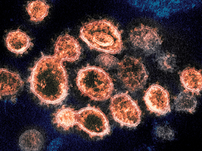 Compared to the original strain, the SARS-CoV-2 variants have been more infectious, more virulent, more resistant to natural or vaccine elicited immunity, or some combination of all three.