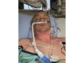 Ivan Pylypchuk is seen in hospital in an undated handout photo. Pylypchuk, a Ukrainian newcomer, was stabbed by a man in what Edmonton police say appears to be a random attack on his way to work. THE CANADIAN PRESS/HO-Leonid Leshchinsky, *MANDATORY CREDIT*