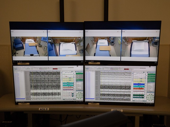  Monitors are seen in the new seizure investigation unit at RUH.