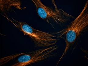 The 2025 U of S Images of Research photo and imaging competition celebrates the beauty and artistry in the work of University of Saskatchewan researchers. The More than Meets the Eye winner was The Hidden Universe Inside Us, by Asmaa Fadl, PhD student, College of Dentistry.