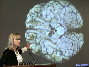 Ann McKee, director Boston University's center for research into the degenerative brain disease CTE, addresses an audience on Nov. 9, 2017