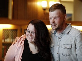 Lilly Ross, left, talks with Andy Sandness after meeting at the Mayo Clinic, Friday, Oct. 27, 2017, in Rochester, Minn. Sixteen months after transplant surgery gave Sandness the face that once belonged to Calen "Rudy" Ross, he met the woman who had agreed to donate her high school sweetheart's face to a man who lived nearly a decade without one. (AP Photo/Charlie Neibergall)