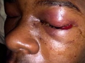 Dafonte Miller was badly beaten in Whitby on Dec. 28, 2016.