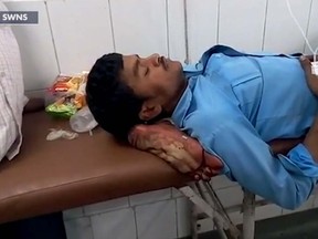 An video obtained by SWNS shows a bus crash victim's amputated foot used as a pillow in a hospital. (SWNS screengrab)