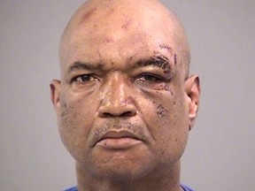 Gary Madison of Indianapolis is seen in an undated booking photo released Sunday, April 8, 2018, by the Marion County Jail. Madison faces three preliminary charges of battery by means of a deadly weapon. (Marion County Jail via AP)