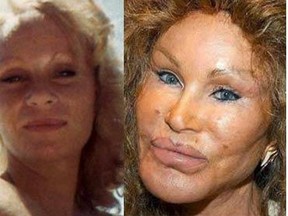 Before and after of Jocelyn Wildenstein. She received billions from her ex-husband and now the New York curiosity is broke.