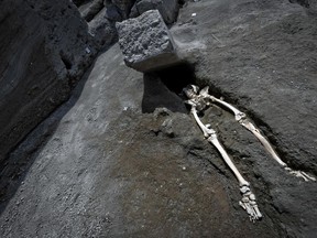 The legs of a skeleton emerge from the ground beneath a large rock believed to have crushed the victim's bust during the eruption of Mt. Vesuvius in A.D. 79, which destroyed the ancient town of Pompeii, at Pompeii's archeological site, near Naples, on Tuesday, May 29, 2018.