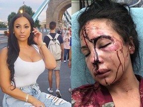 An instagram post by a friend of Delicia Cordon claims that her injuries were caused by Buffalo Bills running back LeSean McCoy.