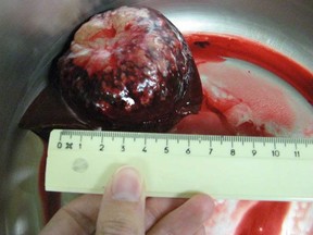 An infected dog liver. (Supplied photo)