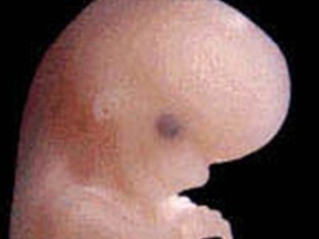 EARLY HUMAN FETUS (64 days postconception) ... has been imaged by magnetic resonance microscopy (MRM) (below) and by traditional light microscopy (right). At this stage, the embryo is about 30 millimeters long.