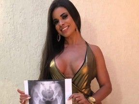 A Miss BumBum contestant shows she has not had any word done on her derriere.