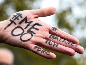 This file photo taken on October 29, 2017 shows the message "#Me too" on the hands of a protester at a rally in Paris. (Getty Images).