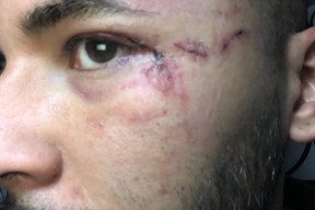 Josue Camposano (GoFundMe)