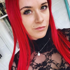 It is likely Maegan Tapley will lose one of her eyes after being attacked by YouTube star Erich Stelzer. FACEBOOK
