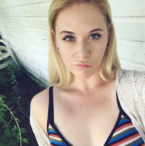 It is likely Maegan Tapley will lose one of her eyes after being attacked by YouTube star Erich Stelzer. FACEBOOK