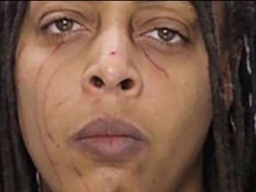 Cops say heartbroken Philadelphia Eagles fan Kirsten Gaskin assaulted her girlfriend and put a dog in a microwave after the team lost to the Saints.