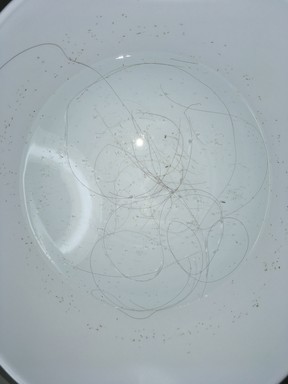 Lice is seen on hair strands in this supplied photo.