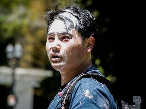 Andy Ngo, a Portland-based journalist, is seen covered in unknown substance after unidentified Rose City Antifa members attacked him on June 29, 2019 in Portland, Ore.