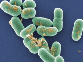 SEM of Listeria monocytogenes
[Photo via Newscom]