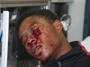 A court exhibit showing injuries sustained by Dafonte Miller.