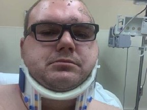 Tow-truck driver Andrew Cortes suffered injuries when he was the victim of a hit and run while on the job. (Supplied photo)
