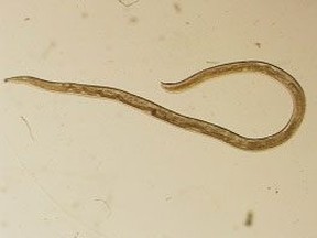 In this undated CDC file photo, an adult female Thelazia gulosa is removed from the surface of the eye of a human, showing intestine and egg-filled ovaries taking up the majority of the length of the body. (CDC)