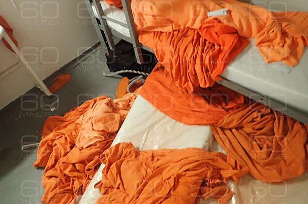 Shocking photos show pedophile Jeffrey Epstein in death | Toronto Sun