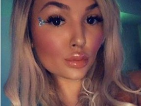 Allyson Danylko says she had her nose bitten off during an argument with her boyfriend. (Instagram)