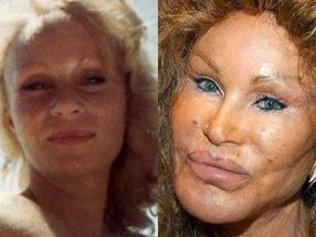 Jocelyn "The Bride of" Wildenstein. Do not let this happen to you. GETTY IMAGES