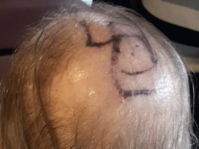 Family members found Larry Morrow, 70, who suffers from Parkinson's and Alzheimer’s, with a swastika drawn on his head while he lived in a quasi-senior’s residence in Toronto's west end. (supplied photo)