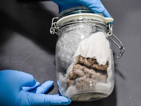 An image released by U.S. Customs and Border Protection of a human brain seized at the Sarnia-Michigan border.