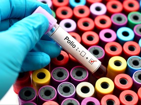 Blood sample positive with polio virus. (Getty Images)