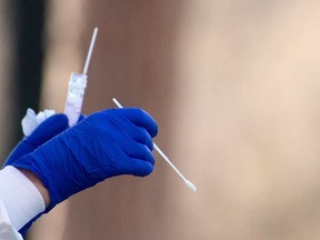 A medical worker holds a swab while preparing to proceed drive-through COVID-19 tests outside the Santa Maria della Pieta' hospital in Rome on April 3, 2020. (Photo by TIZIANA FABI/AFP via Getty Images)