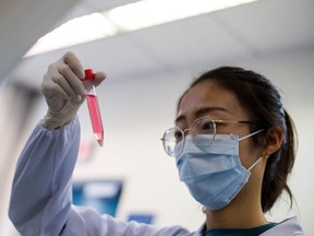 A scientist works in the lab of Linqi Zhang on research into novel coronavirus disease (COVID-19) antibodies for possible use in a drug at Tsinghua University's Research Center for Public Health in Beijing, China, March 30, 2020.