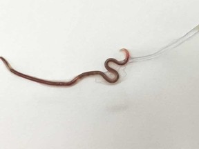 This worm was found in the throat of a Japanese woman. It was still alive.